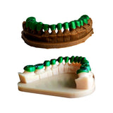 Dental Cast Resin